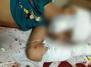 Crime News: ફોઈએ ભત્રીજા પર કર્યો ચપ્પુથી જીવલેણ હુમલો, કારણ જાણીને ચોંકી જશો