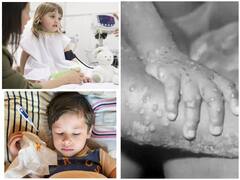 COVID-19: दुनियाभर में कोरोना संक्रमण के बीच इन 3 बीमारियों ने बढ़ाई स्वास्थ्य अधिकारियों की चुनौतियां