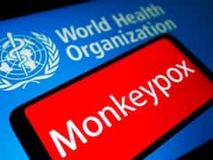 'Risky Sexual Behaviour' At 2 Rave Parties In Europe Likely Spread Monkeypox: Report