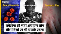 Corona Virus के बाद इन बीमारियों ने बढ़ाया डर| Monkeypox, Unexplained Acute Hepatitis, Tomato Flu
