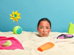 Sunburn Remedies : सनबर्न से स्किन का रंग पड़ सकता है फीका, इन उपायों से करें बचाव