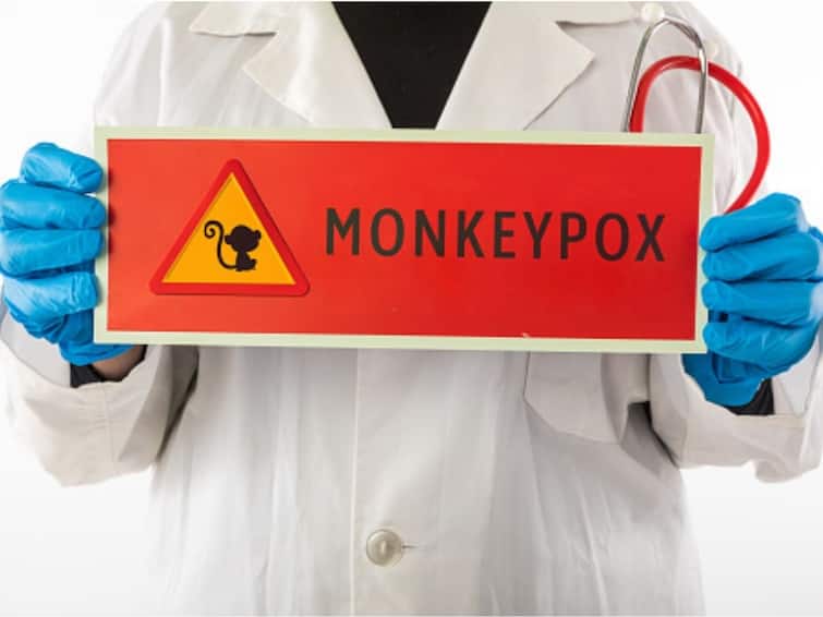 Antivirals May Reduce Symptoms In Monkeypox Patients Suggests Study Antivirals May Reduce Symptoms In Monkeypox Patients, Suggests Study In Lancet