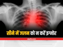 Heart Health: सीने में जलन हो रही है तो इग्नोर न करें, हार्ट अटैक के अलावा इन बीमारियों का हो सकता है संकेत