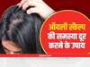 Oily Scalp : ऑयली स्किन से बाल हो सकते हैं बेजान, इन उपायों से पाएं राहत