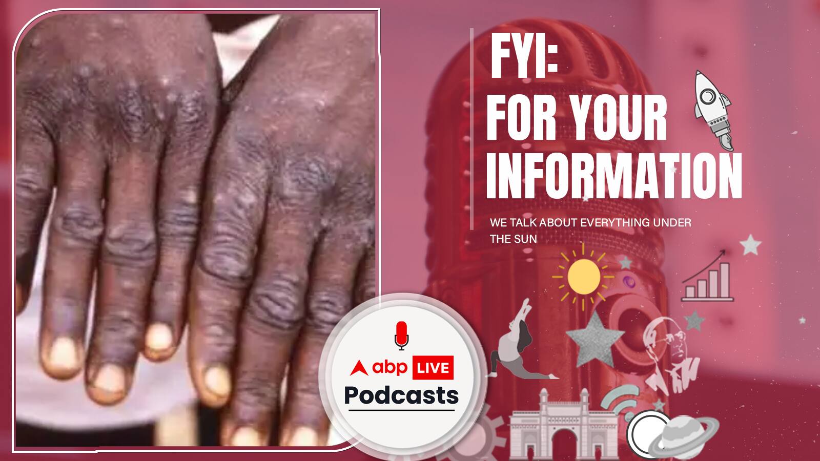 Monkeypox | Corona गया नहीं कि आ गई नई बीमारी, बदन पर पड़ते हैं छाले, फैलती है करीबी शारीरिक संबंध से | FYI | Ep. 246