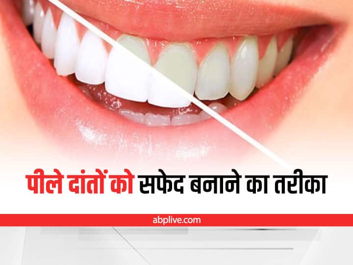 How to make yellow teeth white, follow these home remedies