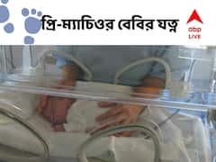 Premature Baby : নির্ধারিত সময়ের আগে ভূমিষ্ঠ সন্তান ? আতঙ্কিত না হয়ে নজর রাখুন এই বিষয়গুলিতে