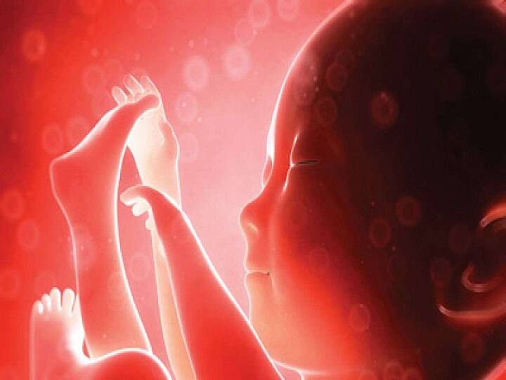 Bihar: Rare fetus in fetu case as child develops inside stomach of 40-day-old baby Fetus in Fetu: 40 நாட்களான குழந்தையின் வயிற்றுக்குள் கரு.. அதிர்ச்சி தந்த சம்பவம்.. அதிர்ந்த பெற்றோர்