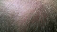 Hair Loss: টানা চুল পড়ছে? কী ভাবে ঠেকাবেন?