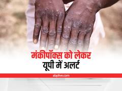 Monkeypox Cases: मंकीपॉक्स के मामलों को लेकर UP में अलर्ट, जारी हुई ये एडवाइजरी