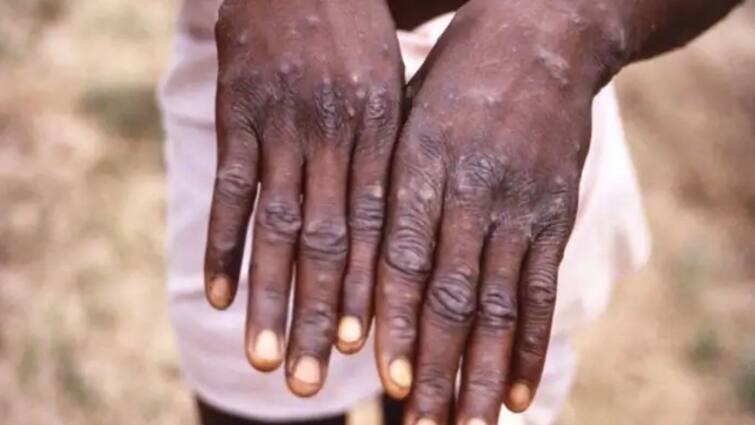 Monkeypox: ‘Isolate Or Kill Pets’, European Authorities Tell Patients, know in details Monkeypox: কেউ মাঙ্কি পক্সে আক্রান্ত হলে তার পোষ্যর কী হবে?