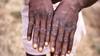 Monkeypox: কেউ মাঙ্কি পক্সে আক্রান্ত হলে তার পোষ্যর কী হবে?