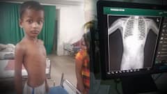 Boy Swallowed 5 Rupee Coin: కాయిన్ ని తీయలేమన్న వైద్యులు | Chittoor | ABP Desam