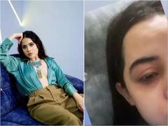 Urfi Javed Health Update: उर्फी जावेद को ऑलिव ऑयल खाना पड़ा भारी, ऐसी हो गई चेहरे की हालत