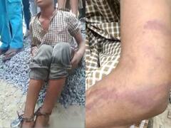Lucknow News: मदरसे में बच्चे के पैर में जंजीर बांधकर की मारपीट, परिजन बोले- बेटा शैतान है, हमारे कहने पर ही मारा
