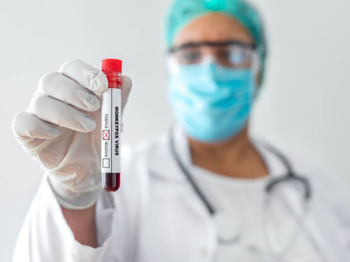 Monkeypox Test Kit Trivitron Medical Devices Company Creates RT-PCR Like Test  To Detect Monkeypox In 1 Hour Monkeypox: Indian Company Develops RT-PCR Like Test To Detect Virus In 1 Hour