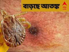 Scrub Typhus : জ্বর এসেছে? একটুও দেরি নয়, বাড়ছে স্ক্রাব টাইফাসে আক্রান্তের সংখ্যা