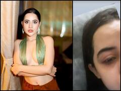 ओह नो! Urfi Javed के चेहरे का हुआ ऐसा बुरा हाल, वजह जानकर रह जाएंगे हैरान, देखिए तस्वीरें