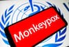 Nearly 200 Cases Of Monkeypox In Over 20 Countries, India On Alert | Top Updates