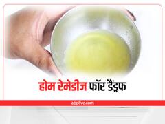 Home Remedies: गर्मियों में डैंड्रफ से पा सकते हैं छुट्टी, अपनाएं ये घरेलू तरीके