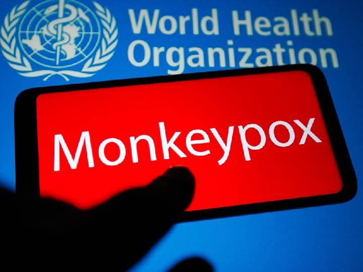 Monkey Pox scare in India Gaziabad Girl having Symptoms Sample send to NIA Pune reports await Monkey Pox : ভারতে হানা মাঙ্কি পক্সের? নমুনা মেলায় আইসোলেশনে বালিকা, রিপোর্টের অপেক্ষা