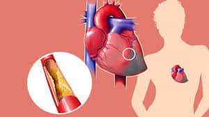 Health Care: ਲੋਕਾਂ 'ਚ ਵਧ ਰਹੀ ਕੋਲੈਸਟ੍ਰੋਲ ਦੀ ਸਮੱਸਿਆ,  ਜਾਣੋ ਕੋਲੈਸਟ੍ਰੋਲ ਕੀ ਹੈ? ਇਸ ਸਮੱਸਿਆ ਦੇ ਕਾਰਨ ਤੇ ਲੱਛਣ