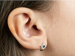 In A First, Patient Receives 3-D Printed Ear Implant Made From Her Own Cells