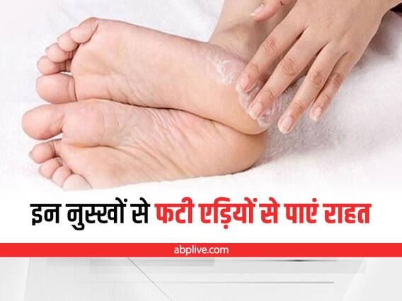 Cracked Heels: फटी एड़ियों से हैं परेशान? अपनाएं ये असरदार घरेलू उपाय Cracked Heels: फटी एड़ियों से हैं परेशान? अपनाएं ये असरदार घरेलू उपाय