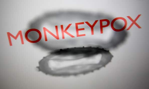 Monkeypox | Over 700 Cases Reported Globally Including 21 In US: CDC Monkeypox | Over 700 Cases Reported Globally Including 21 In US: CDC