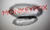 Monkeypox | Over 700 Cases Reported Globally Including 21 In US: CDC