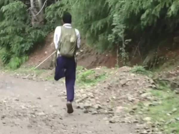 Jaipur Foot USA Chairman Promises Free Artificial Limb To Specially-Abled J&K Boy Jaipur Foot USA Chairman Promises Free Artificial Limb To Specially-Abled J&K Boy