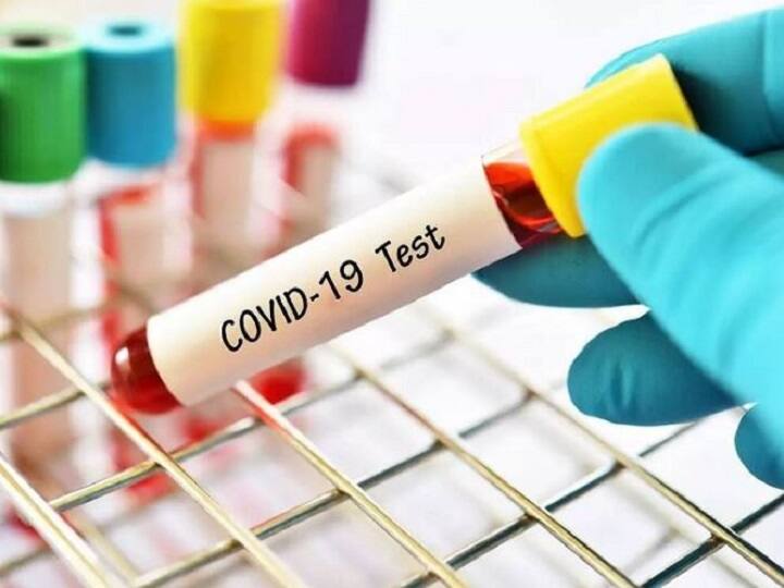 MP RT-PCR Test Charge Coronavirus RT-PCR test will be done  for 75 to 78 rupees in mp now ann MP RT-PCR Test Charge: मध्य प्रदेश में कोरोना के मामलों में कमी आते ही RT-PCR टेस्ट हुआ सस्ता, अब सिर्फ इतने रुपये में होगी जांच