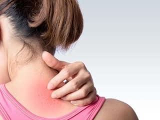 Health Tips : अंगावर खाज येत असेल तर करा 'हे' घरगुती उपाय; लगेच मिळेल आराम