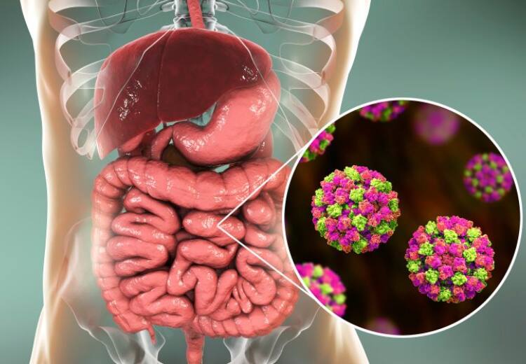 NoroVirus : கேரளாவில் பரவும் நோரோ வைரஸ்.. நோரோ வைரஸ் என்றால் என்ன? என்ன தெரிந்துகொள்ளவேண்டும்? Explainer on Norovirus that was spread among children in Thiruvananthapuram in Kerala NoroVirus : கேரளாவில் பரவும் நோரோ வைரஸ்.. நோரோ வைரஸ் என்றால் என்ன? என்ன தெரிந்துகொள்ளவேண்டும்?
