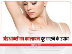 Dark Underarm Remedies: अंडरआर्म्स का कालापन कैसे करें दूर? जानें घरेलू उपाय