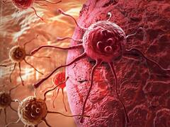 Cancer Drug: मिल गई कैंसर की दवा! ड्रग ट्रायल में 6 महीने में ही पूरी तरह ठीक हो गए मरीज