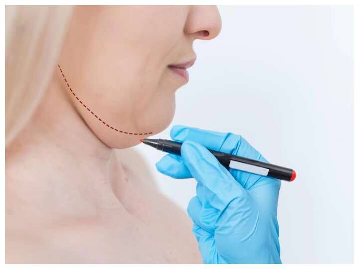 चेहरे पर अगर डबल चिन है तो ये आपकी खूबसूरती को खराब कर सकती है. इसकी वजह से तस्वीरे तो खराब आती ही हैं, साथ ही आपका कॉन्फिडेंस लेवल भी गिर जाता है. इससे छुटकारा पाने के लिए आप ये एक्सरसाइज करें.