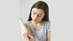 Skin Problem: আসছে বর্ষাকাল, ত্বকের যে সমস্যাগুলি দেখা দিতে পারে