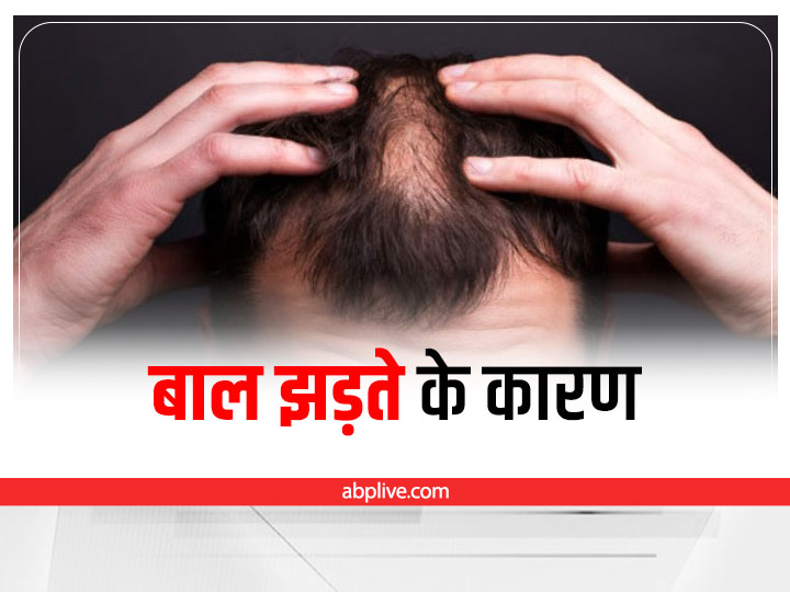 Hair Care Tips हयर फल क समसय क दर करन क लए फल कर य आसन  टपस  Follow these easy tips to overcome the problem of hair fall