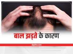 Hair Fall Reason : बाल क्यों झड़ते हैं? आइए जानते हैं इसके कारण और बचाव के टिप्स