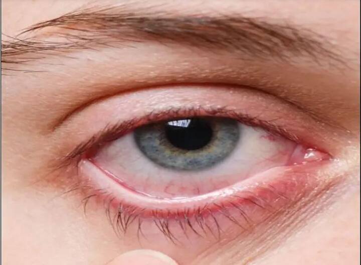 রিপোর্ট বলছে, ন্যাশনাল ফার্মাসিউটিক্যাল প্রাইসিং অথরিটি (এনপিপিএ) ডোলো, সারিডন, ফ্যাবিফ্লু, ইকোস্প্রিন, লিমসি, সুমো, ক্যালপোল, থাইরনর্ম, আনওয়ানটেড 72 ও কোরেক্স সিরাপের মতো বড় ব্র্যান্ডকে এই কিউআর কোডের অন্তর্ভুক্ত করতে চাইছে। এই ওষুধগুলি জ্বর, মাথাব্যথা, গর্ভাবস্থা এড়ানো, কাশি, ভিটামিনের অভাব ইত্যাদিতে ব্যবহৃত হয়।