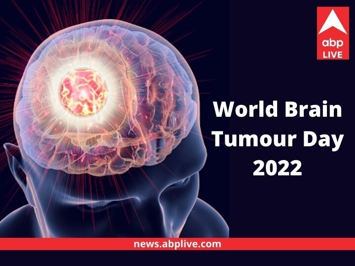 World Brain Tumor Day 2021: All You Need to Know about Brain Tumors, their  Symptoms and Treatments - News18