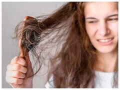 Hair Care Tips: झड़ते बालों से हैं परेशान, तो घर पर बनाएं अनियन ऑयल का ऐसे करें इस्तेमाल