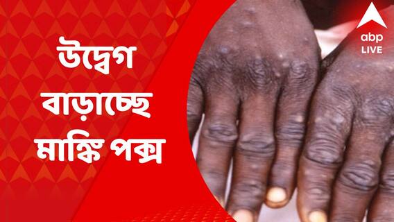 Monkey pox: বিশ্বজুড়ে উদ্বেগ বাড়াচ্ছে মাঙ্কি পক্স। Bangla News