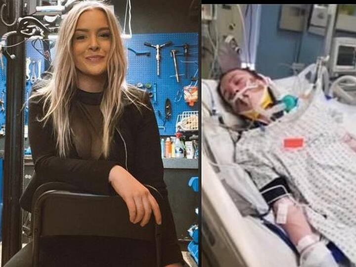 Woman Who Nearly Died Went Into Coma Wakes Up To Find Her Boyfriend Of 4 Years Has New Lover கோமாவுக்கு போன காதலி.. காணாமல் போன காதலன்! 4 வாரத்தில் முடிந்த 4 வருட காதல்!