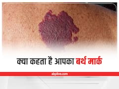 Astro for Birthmark: क्या आपके शरीर पर भी है बर्थ मार्क, जानिए शरीर के इन अंगों पर इसके होने का मतलब