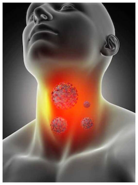 गले की खराश के घरेलू उपाय