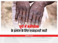 Monkeypox: यूपी में मंकीपॉक्स के इलाज के लिए एडवाइजरी जारी, राज्य में अभी तक एक भी मरीज नहीं