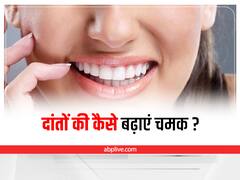 Teeth Whitening  : सफेद और चमकते हुए दांत पाने के लिए अपनाएं ये असरदार नुस्खा
