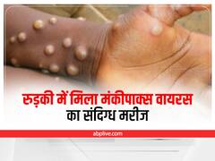 Roorkee News: रुड़की में मिला मंकीपाक्स वायरस का संदिग्ध मरीज, स्वास्थ्य विभाग ने जारी की एडवाइजरी